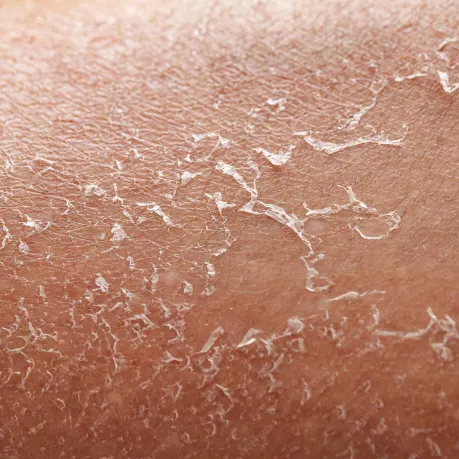 Nourrir et hydrater la peau seche durablement avec des cosmetiques naturels bio vegan